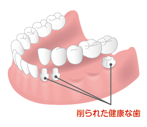 ブリッジ